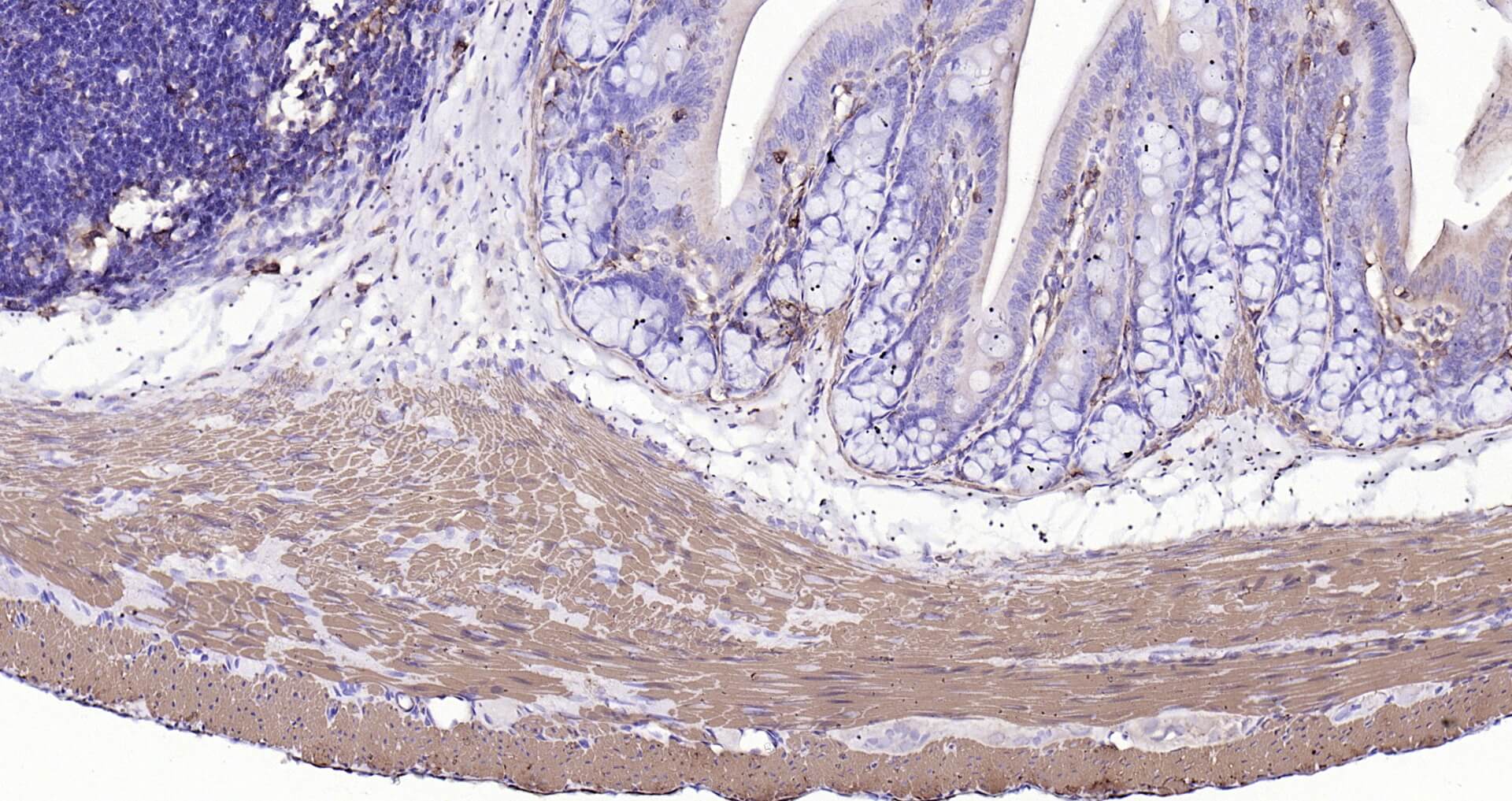 肌动蛋白α/α-SMA/α Actin单克隆即用型免疫组化试剂盒-IHC0114
